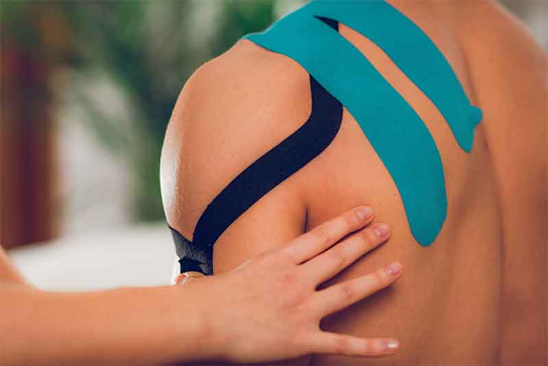 Myofascial taping applied to shoulder